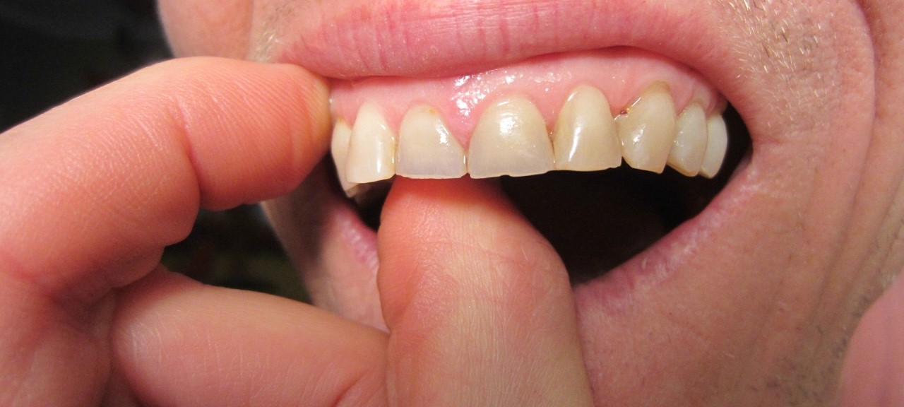7 Steps to Strengthen Your Teeth and Gums Naturally