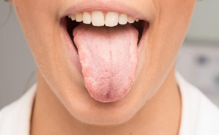 white-tongue-causes-11-natural-remedies-to-make-it-healthier-origin